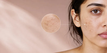 Face Pigmentation