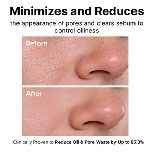 Womenhood Zero Pore Pads