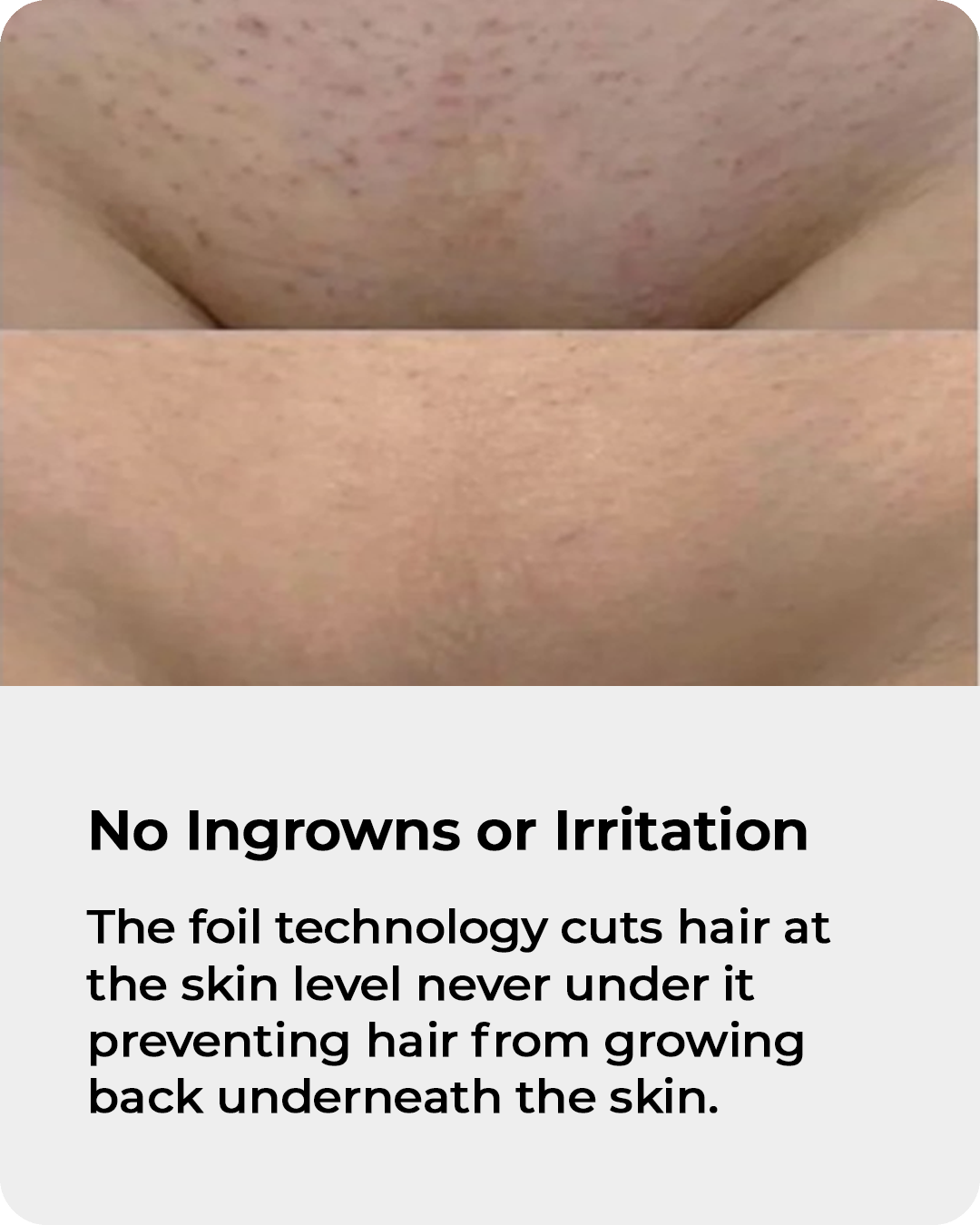 Why Women Are Ditching Their Razors For 5 in 1