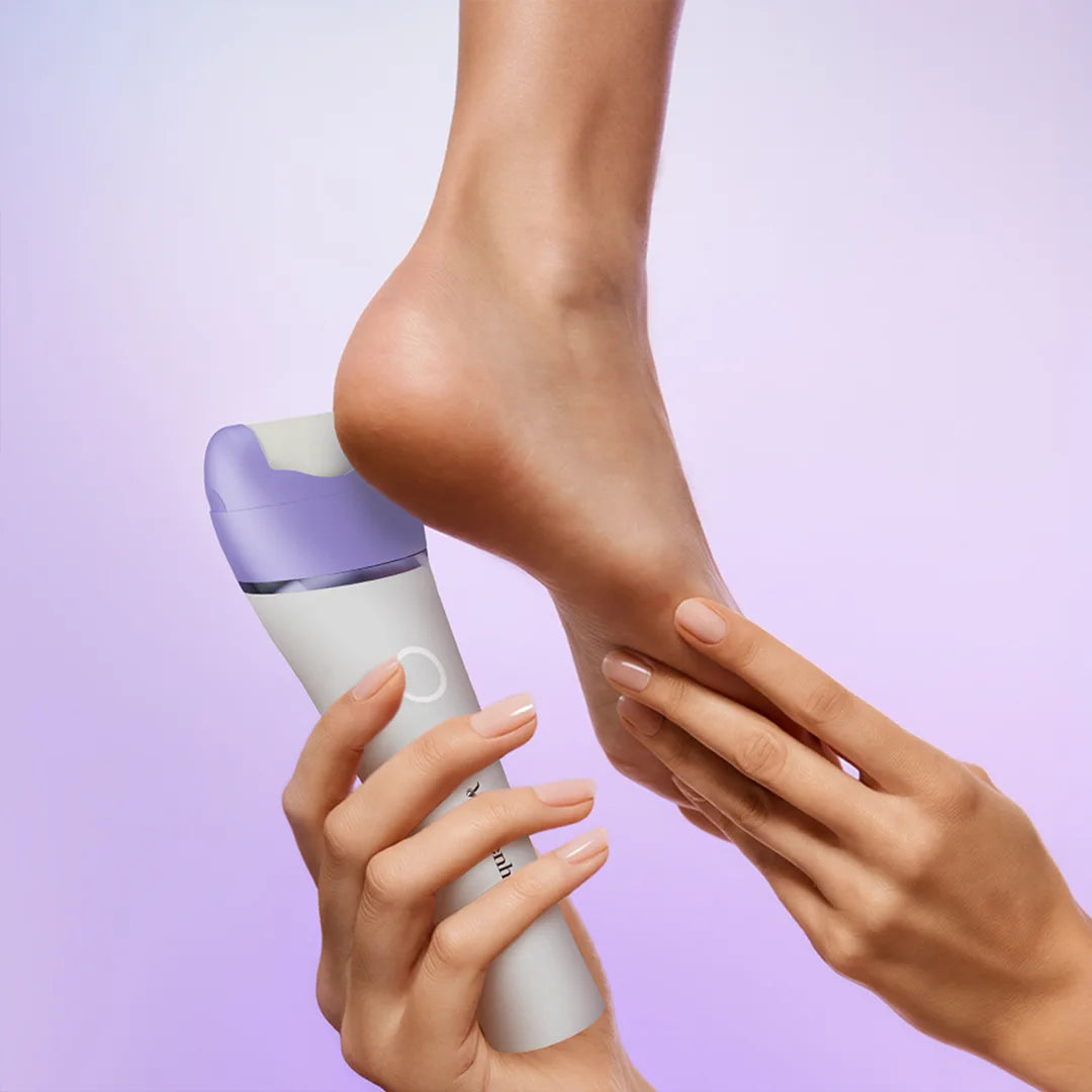 Say Goodbye to Cracked Heels, Instantly