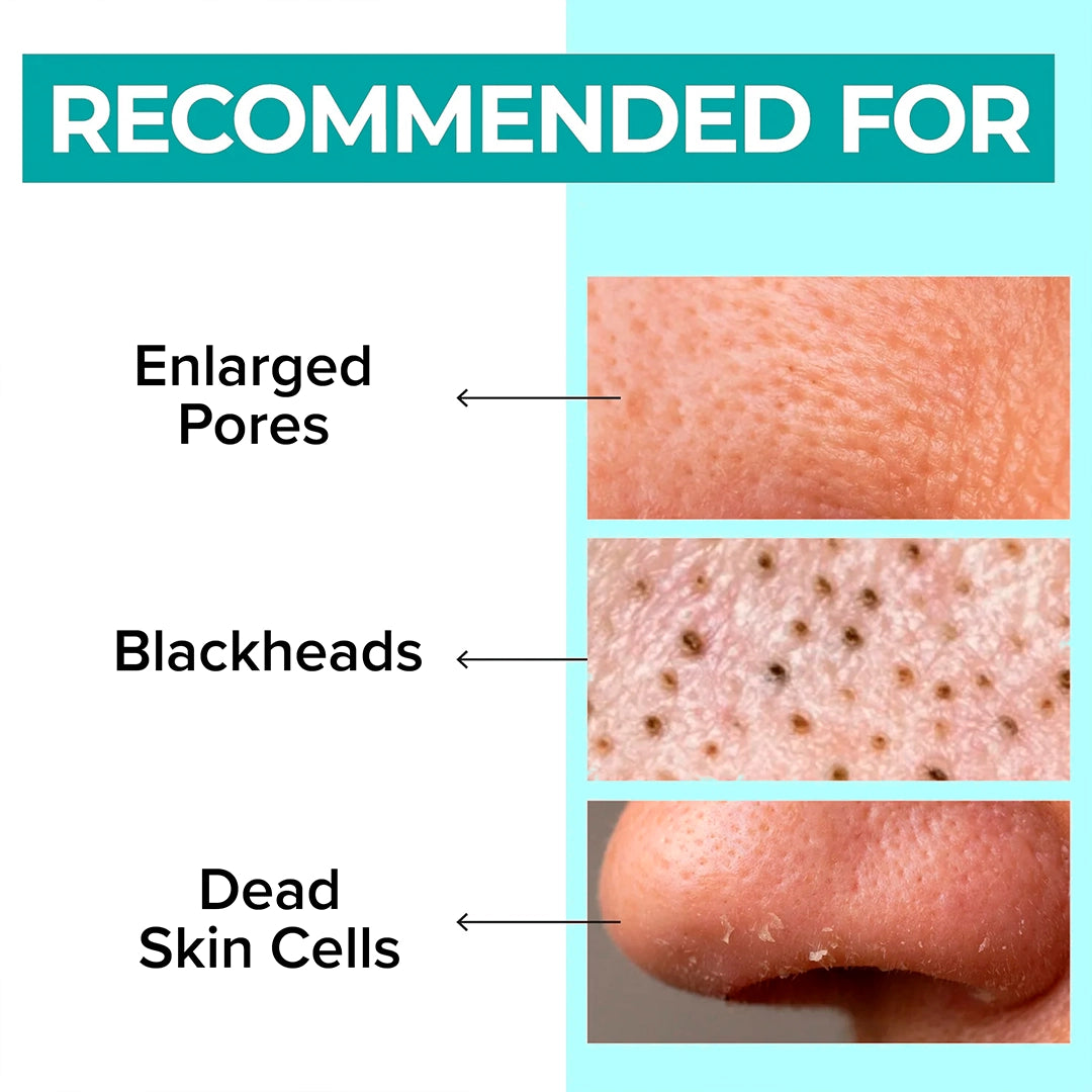 Womenhood Zero Pore