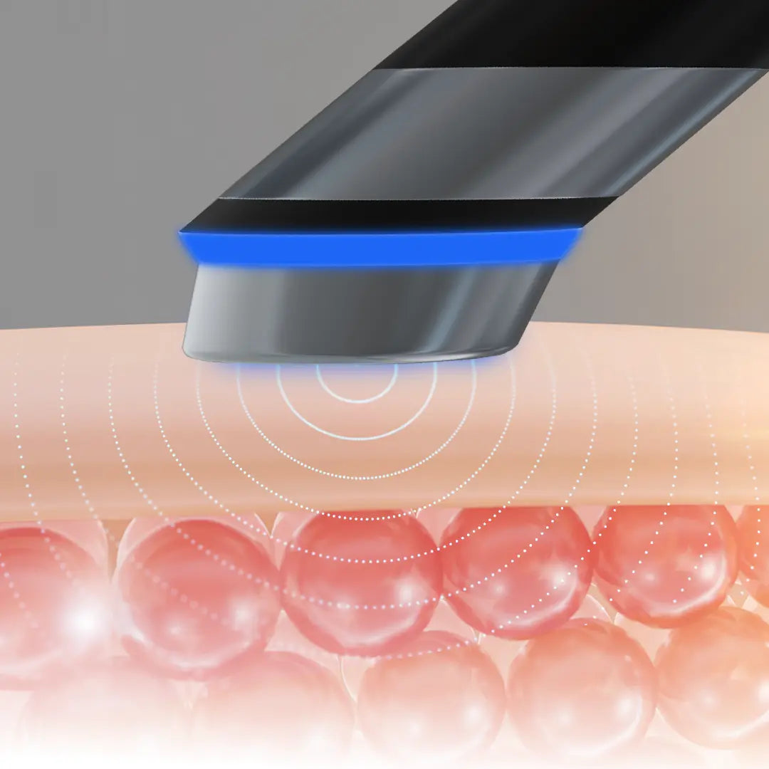 Needle Free Glow Poration Technology
